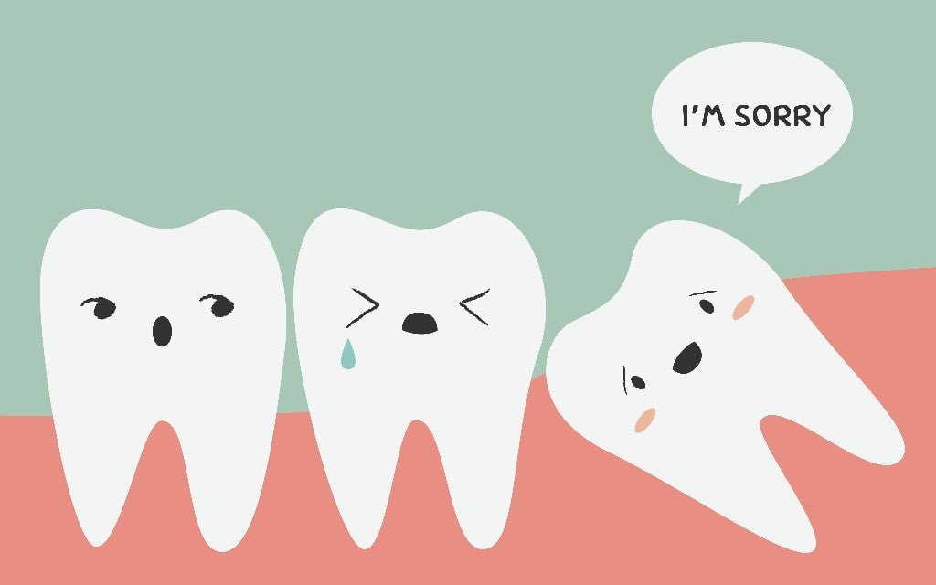 wisdom teeth crowding