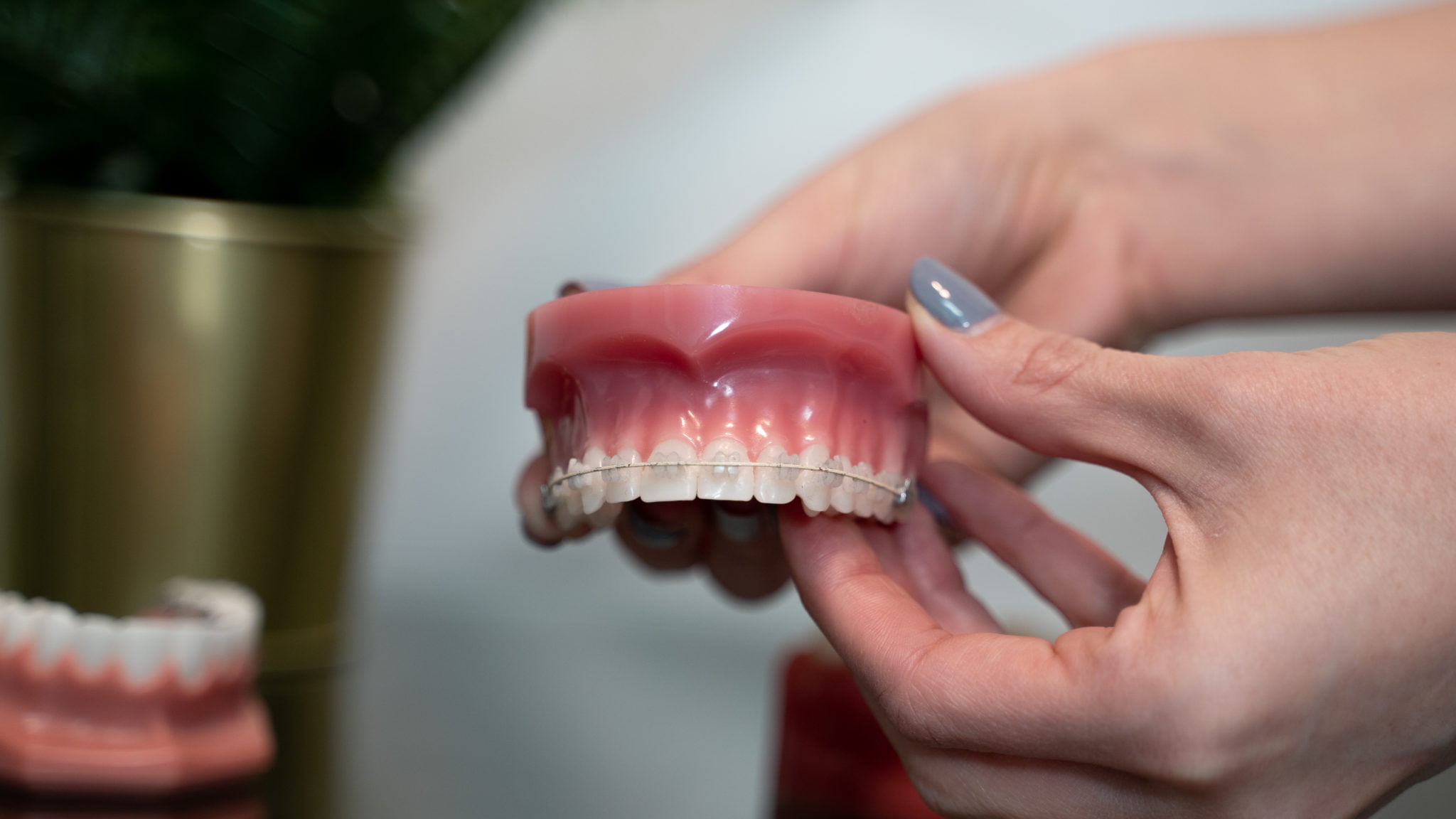 how braces work?