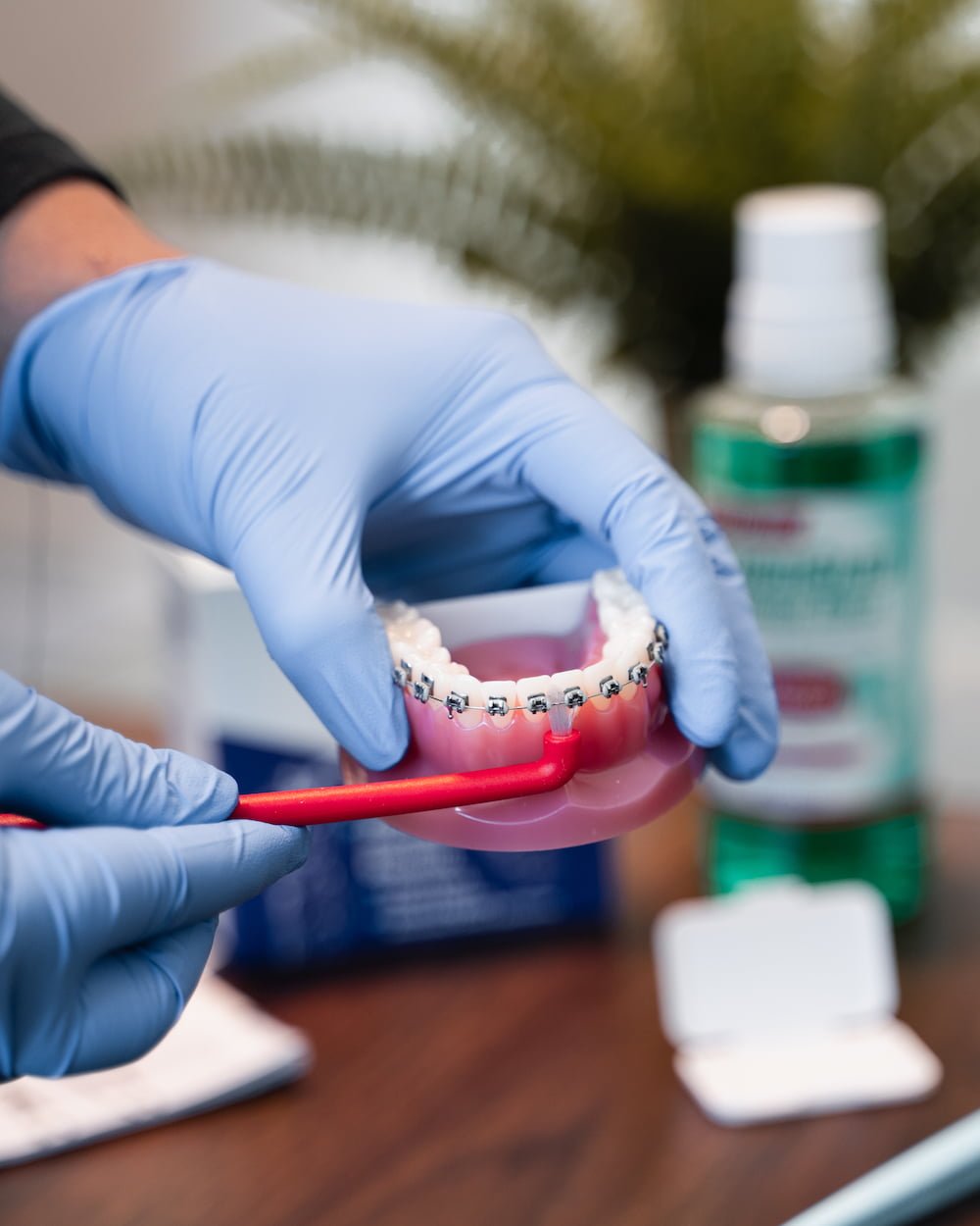 How to look after braces & retainers Brace Care