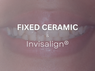 Fixed Ceramic Braces & Invisalign before and after