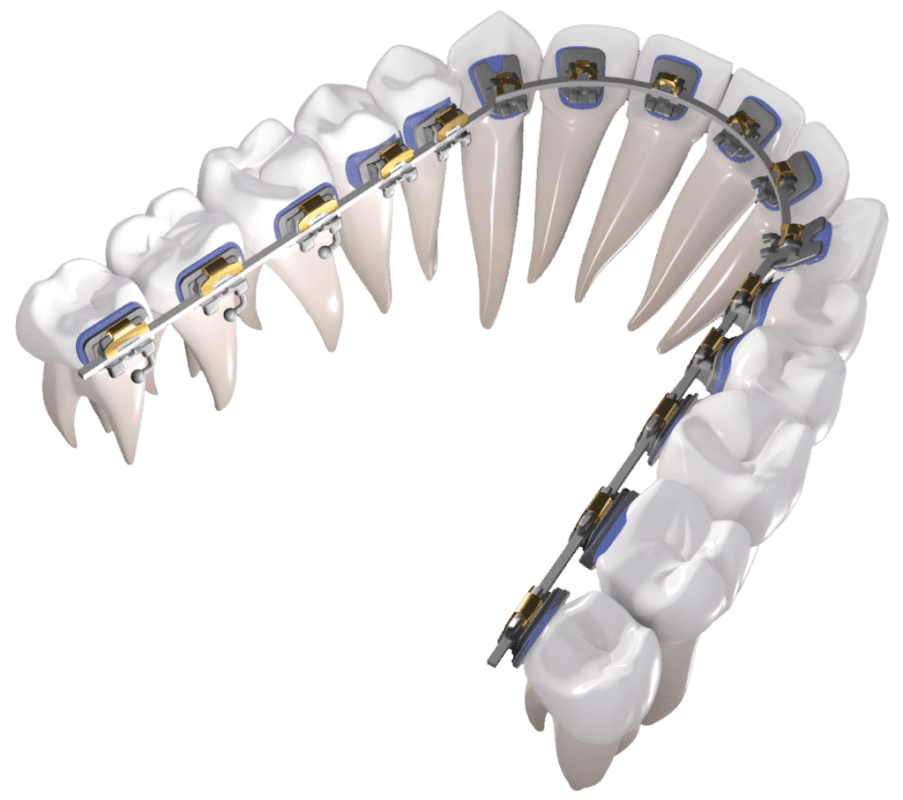 In Ovation L 1024x907