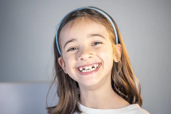 Child in mixed dentition interceptive treatment