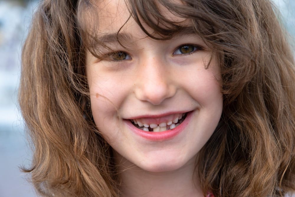 Dental misalignments in children