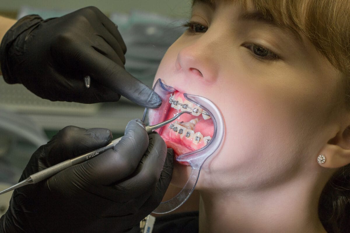 Specialist Orthodontist vs Dentist