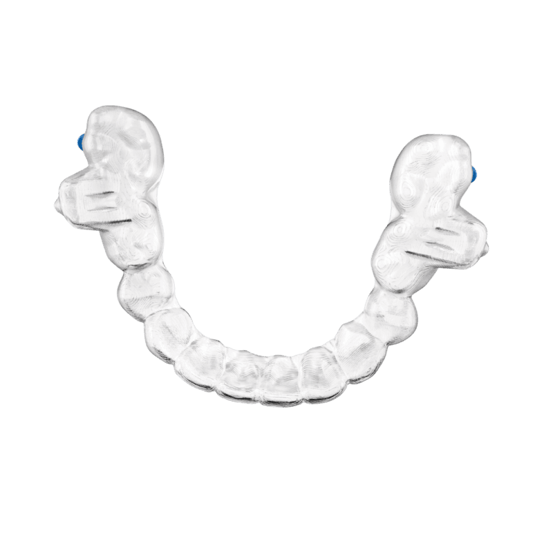 Invisalign Class Ii Overhead On White Png Img104